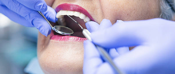 Best Chipped Tooth Repair Near Me  in East Bernard, TX
